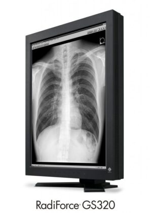 Monitor Diagnostico Para cr dr Torax Cod Gs320