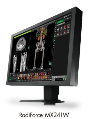 Monitores visualizacion